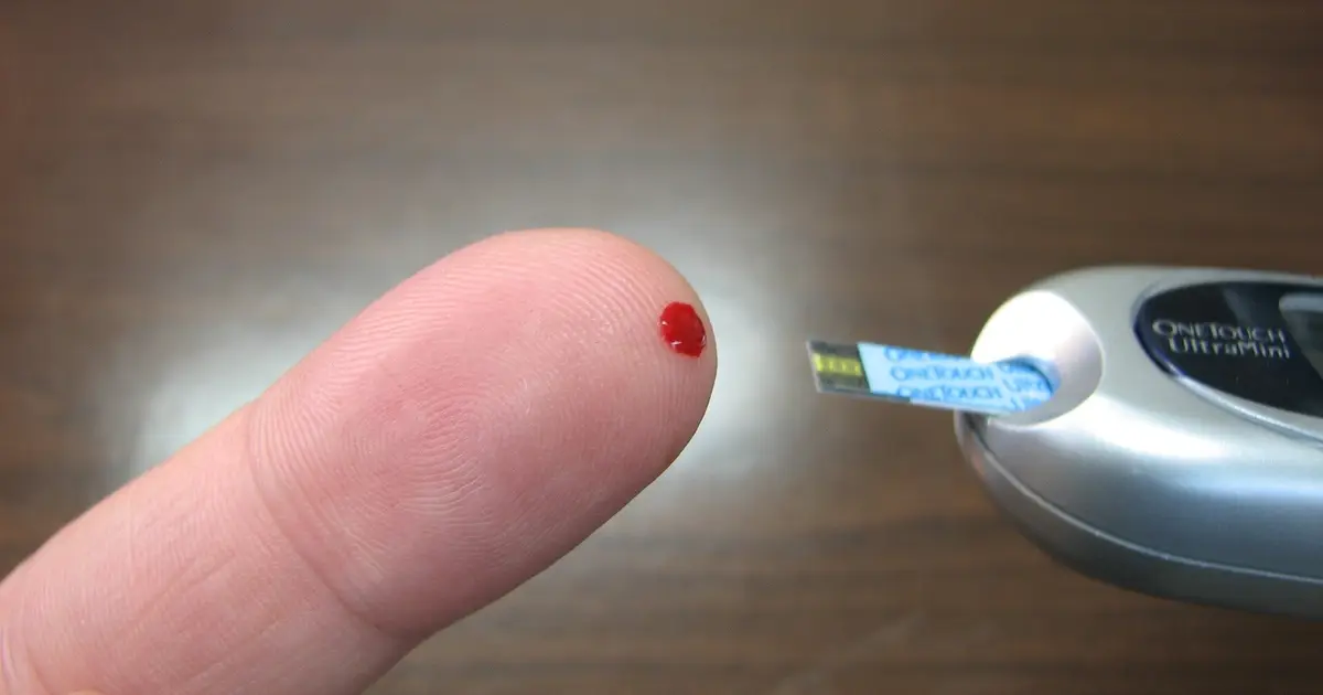 Continuous glucose monitors may reveal hidden heart risk patterns in adults without diabetes