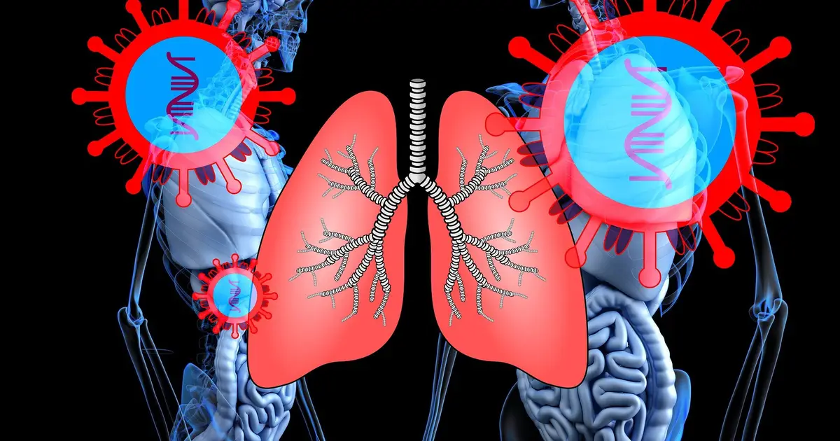 Younger adults with lung cancer more likely to have targetable genetic changes, study finds