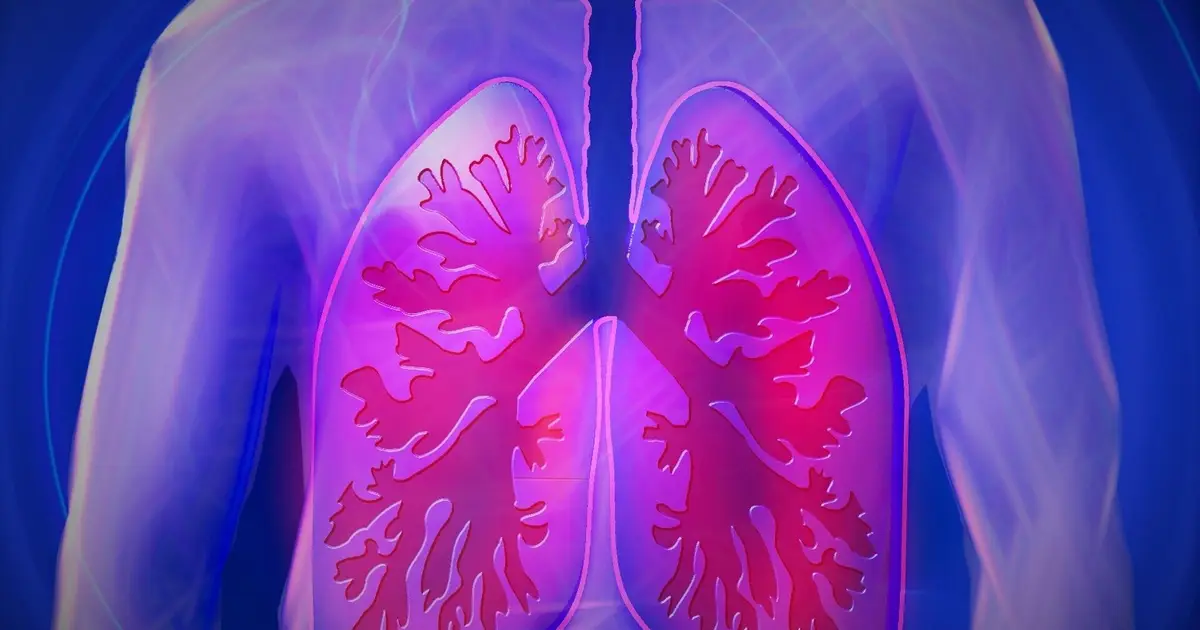 New expert recommendations aim to improve detection and care of lung disease in people with rheumatoid arthritis