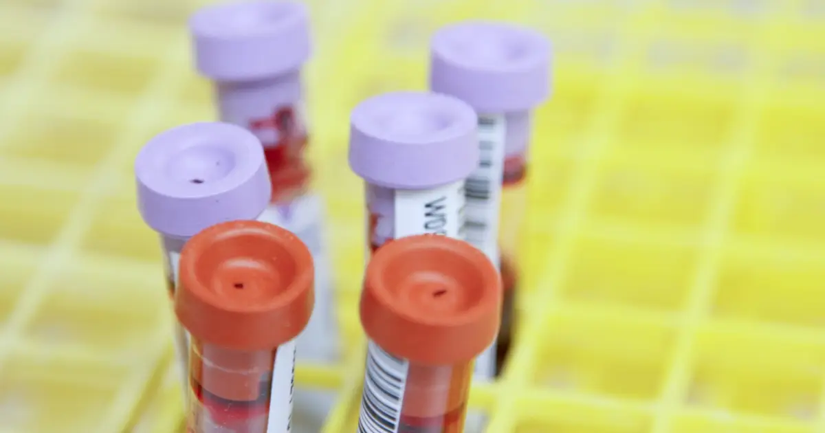 Study points to broader stem cell donor options for blood cancer patients