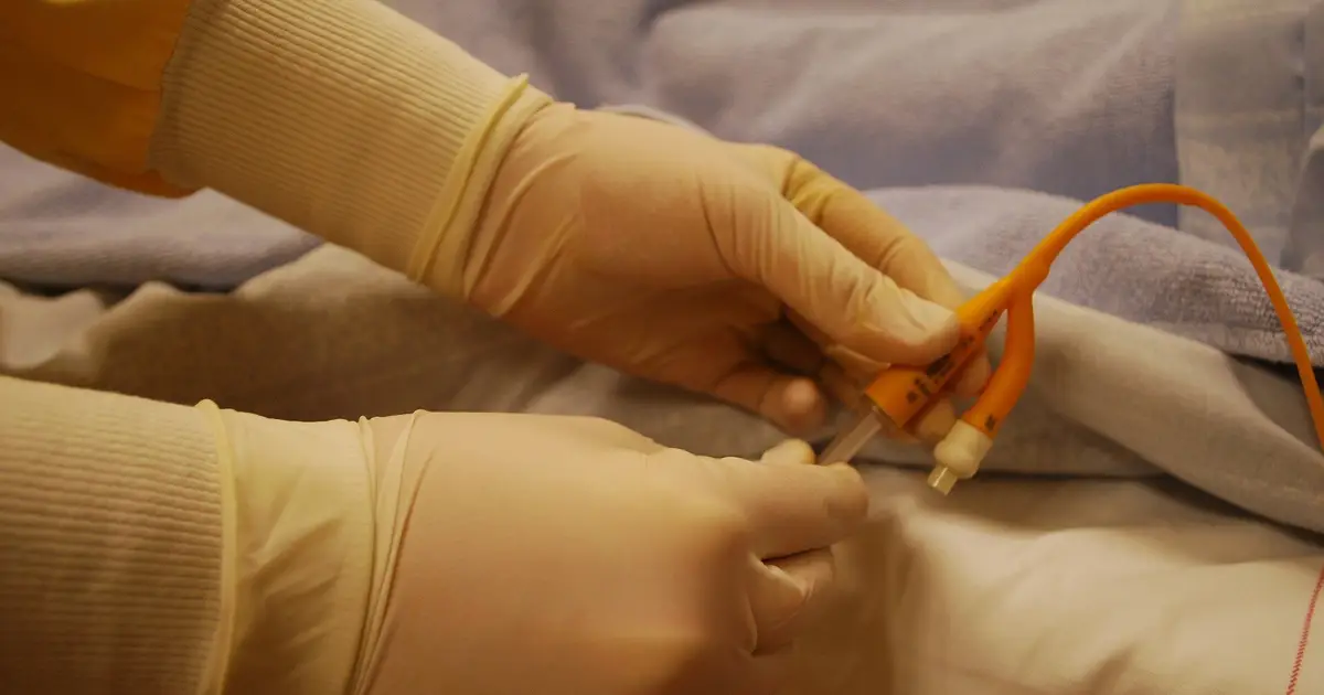 Catheter-directed therapy improves pulmonary embolism outcomes