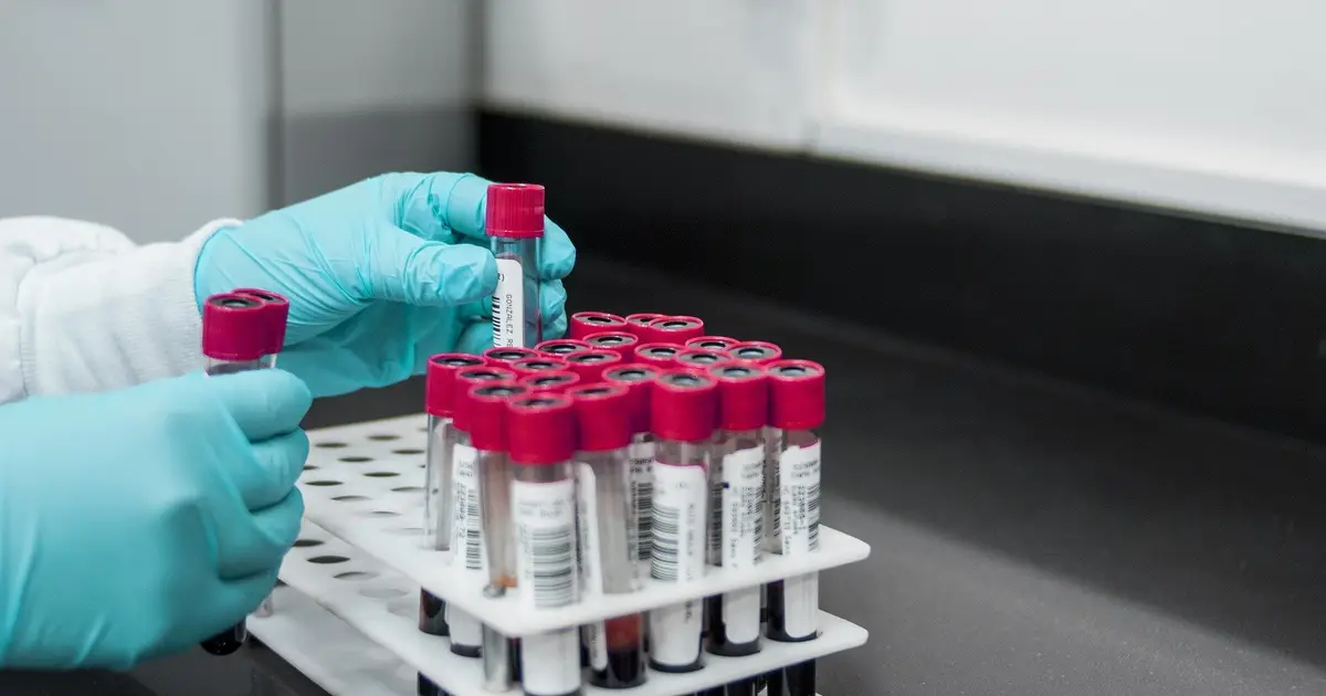 Activated donor immune cells may prevent severe complication after allogeneic stem cell transplantation