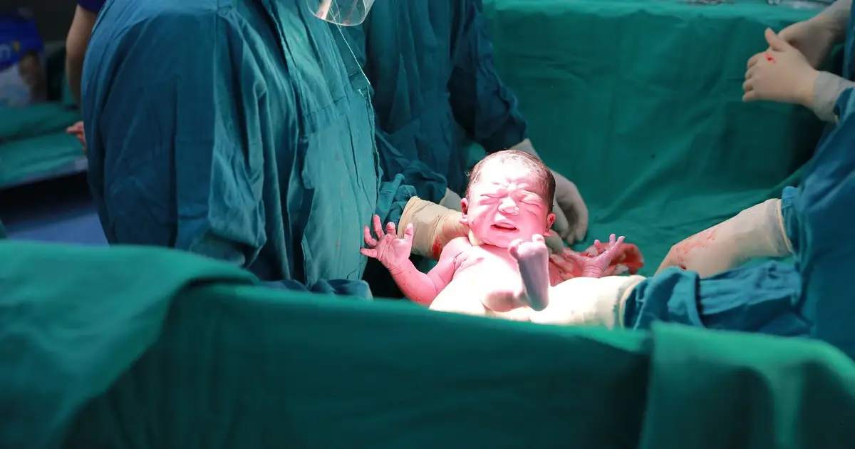 Chronic pain after cesarean delivery linked to poorer quality of life for months and years after giving birth