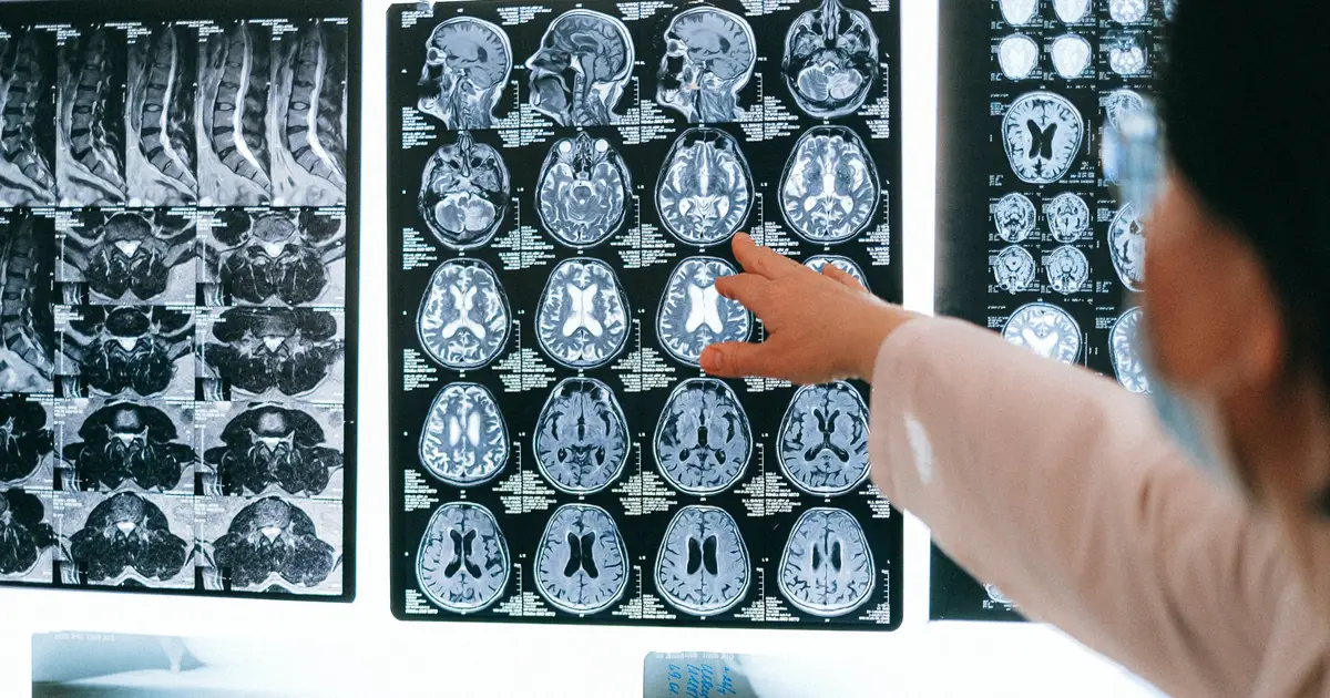 Advanced MRI data set maps adolescent brain development