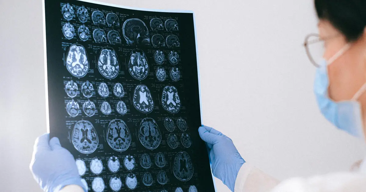Researchers discover pathway that makes glioblastoma cells vulnerable to treatment