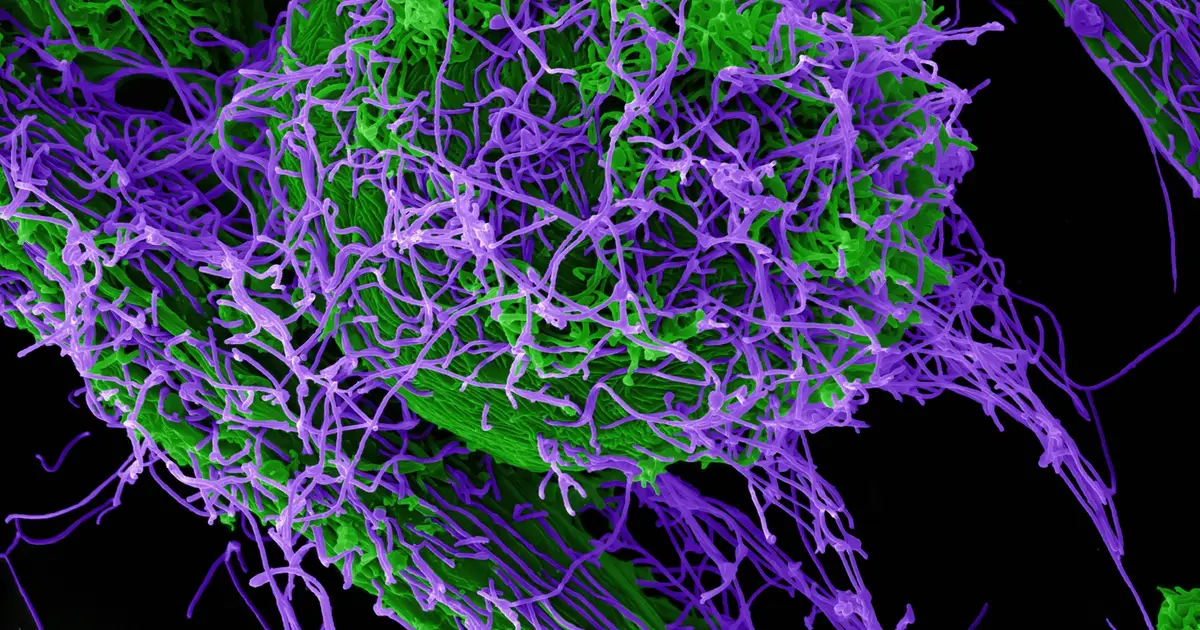 10 years after Ebola in West Africa: Laboratory partnership improves viral hemorrhagic fever diagnostics in Guinea