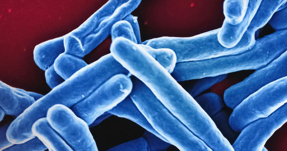 Potential new TB vaccines could save millions of lives: Gavi
