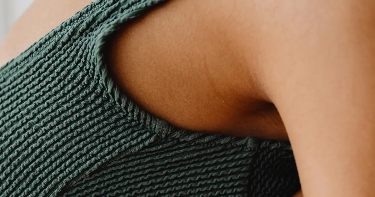 Recommendations developed for management of hidradenitis suppurativa
