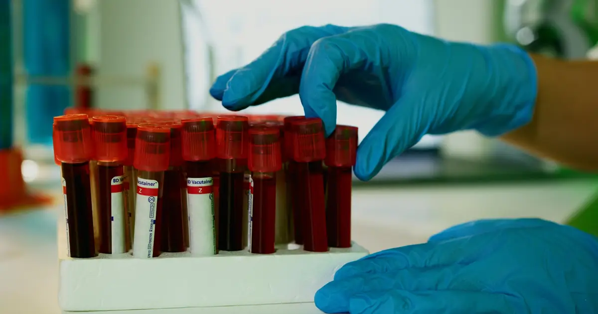 Blood test that detects tumor DNA could help guide treatment when cancer has spread