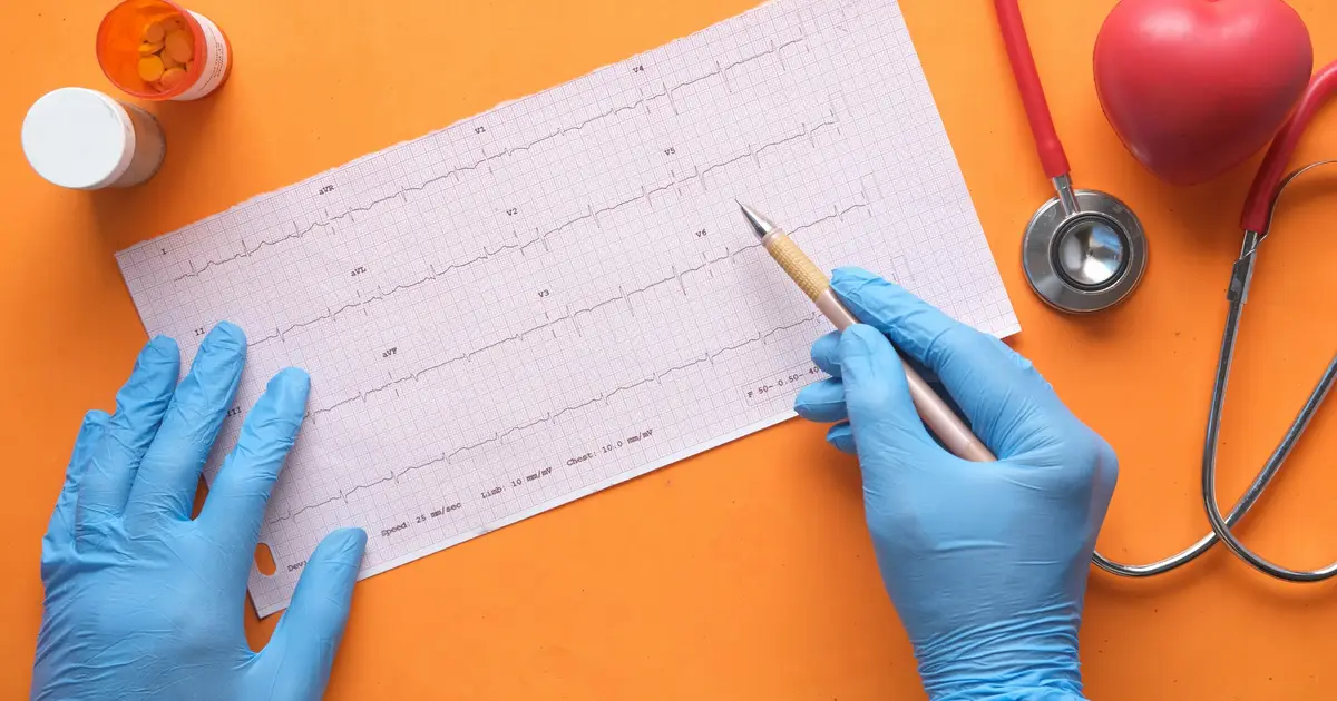 Two-week monitor after unexplained fainting identifies life-threatening heart conditions