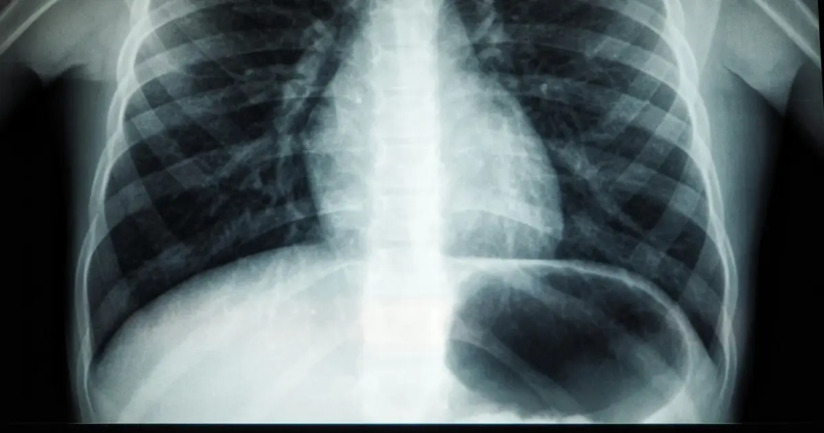 Light switch wakes lung cancer cells up from a protective dormant state