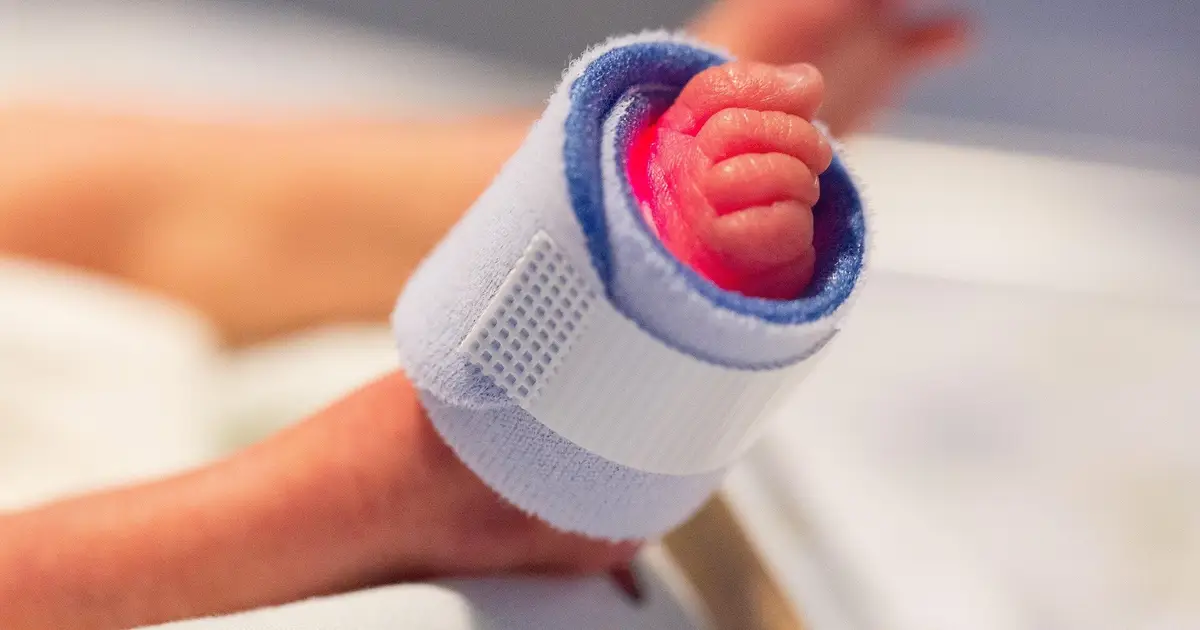 Study reveals subtle neuroimaging differences after late preterm birth