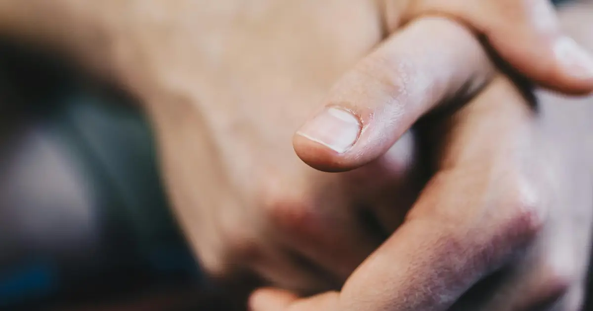 The skin microbiota—billions of microbes that protect or harm