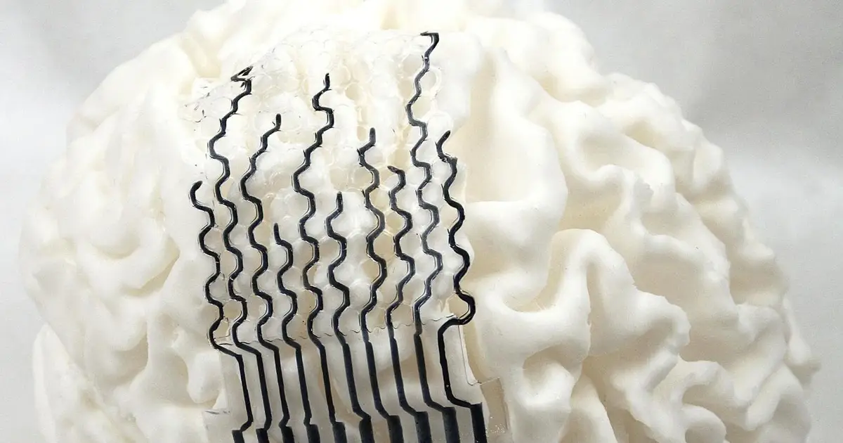 3D-printed brain sensors may unlock personalized neural monitoring