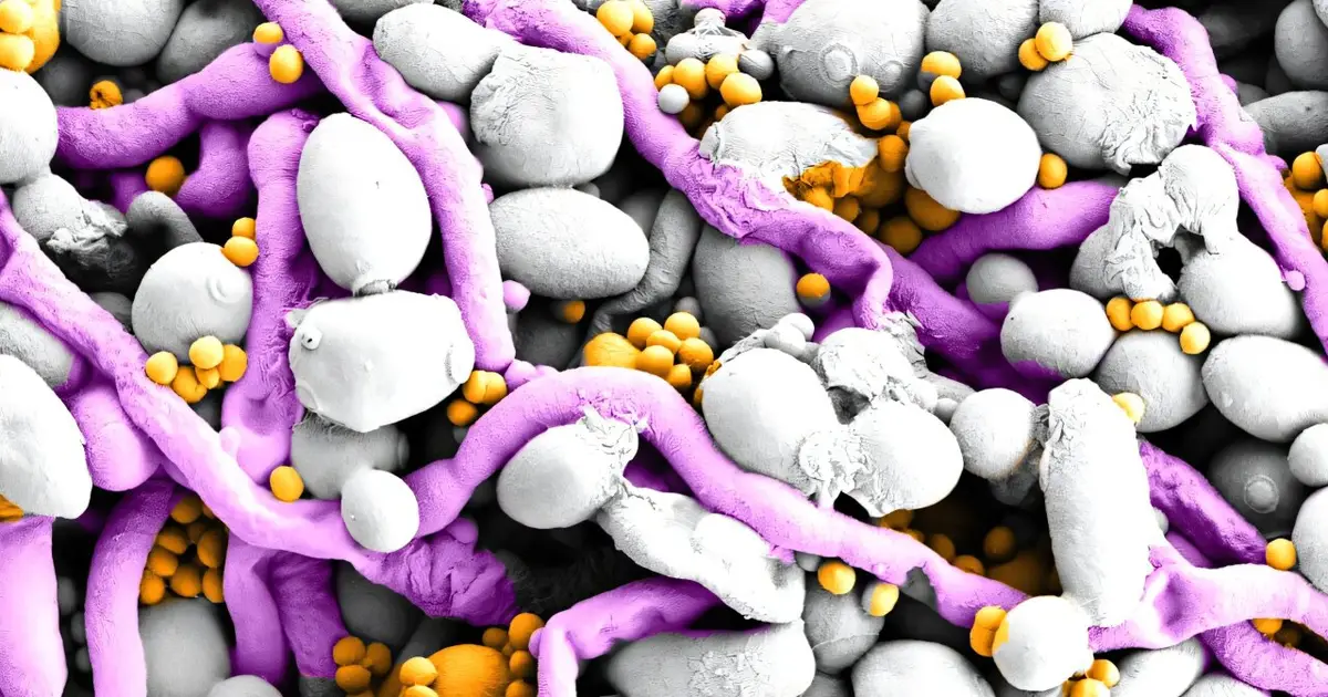 How a 'copper economy' helps fungi and bacteria build stubborn biofilms