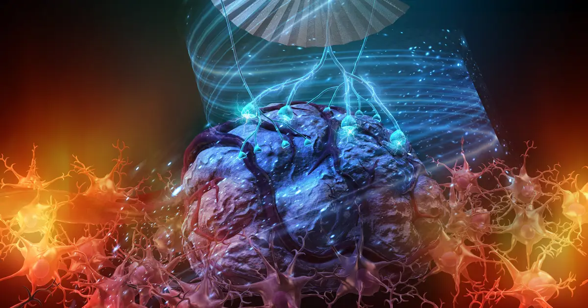 Brain's inhibitory circuits emerge as a potential brake on adult glioma progression
