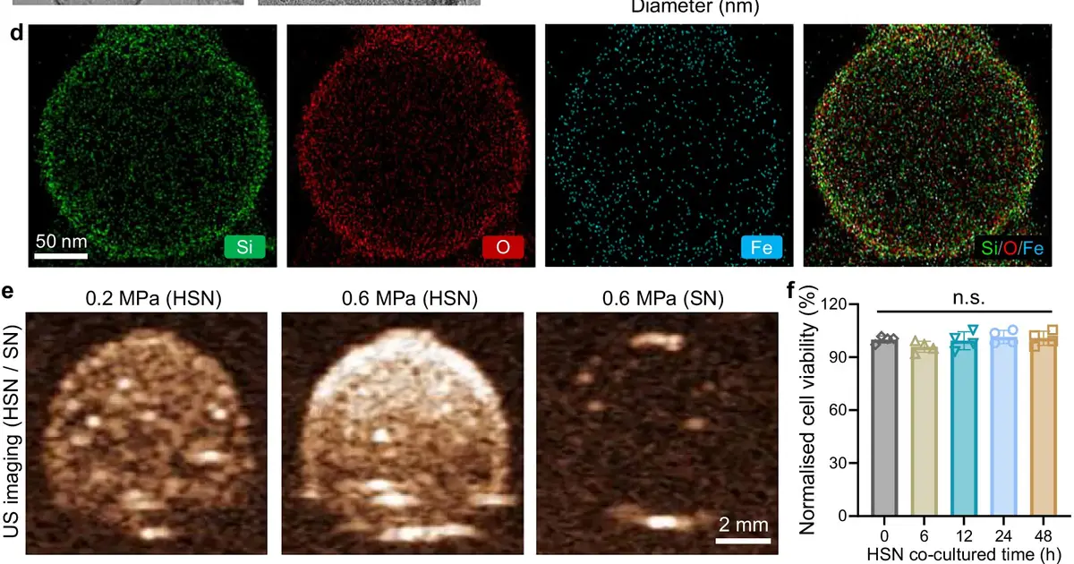 Nanostructure-assisted ultrasound shows potential for Parkinson's treatment