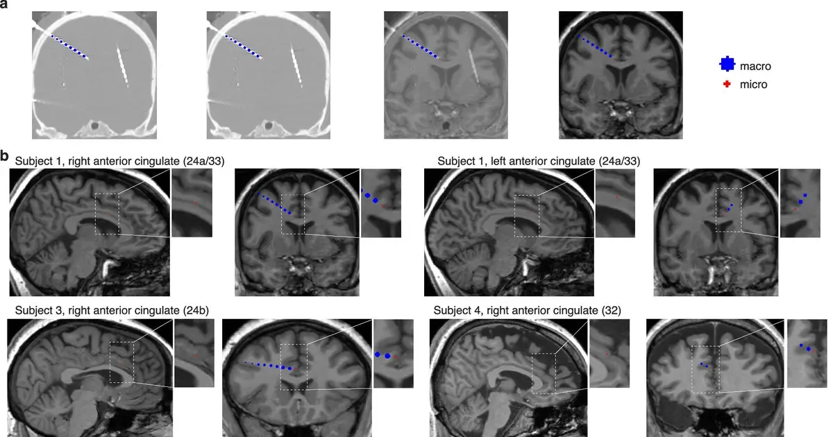 A poorly understood brain region tracks the gap between expectations and reality
