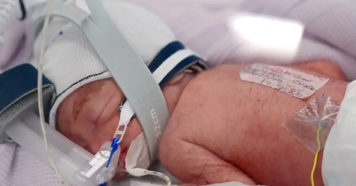 An Australian woman gives birth to rare identical quadruplet girls