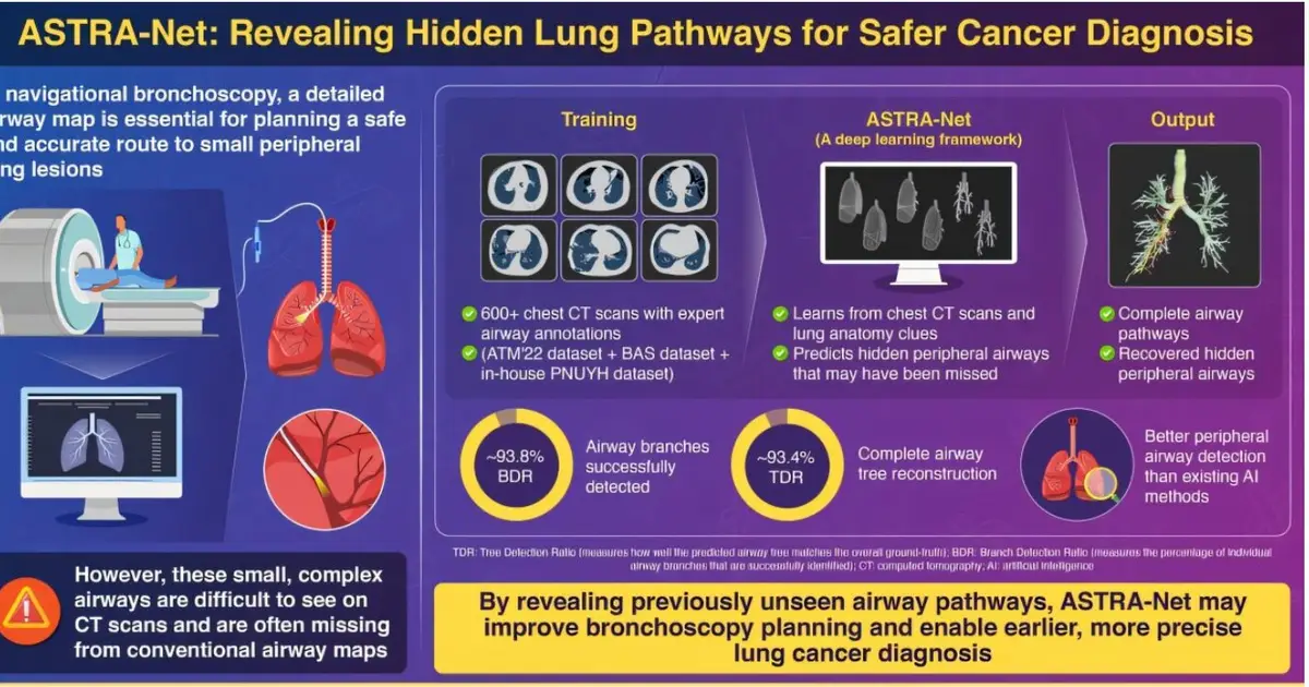 AI uncovers overlooked lung airways to improve bronchoscopy maps