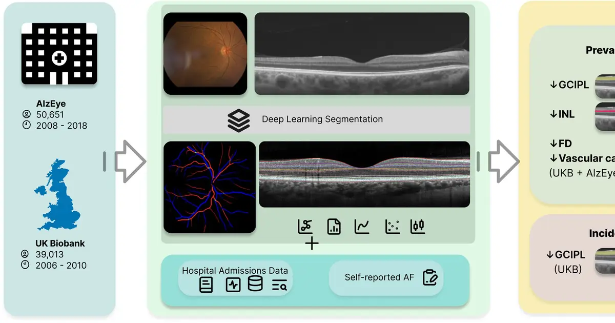 Retinal scans may flag atrial fibrillation four years before diagnosis