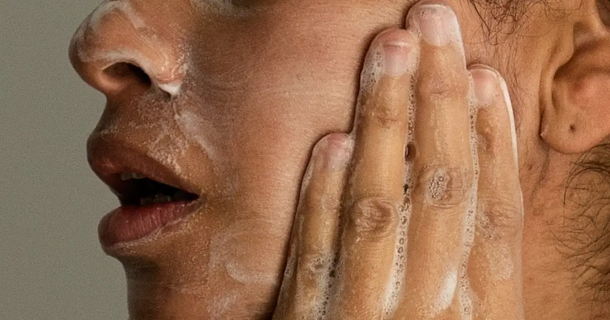 Adult acne is real, but there are ways to treat it. Here's what to know