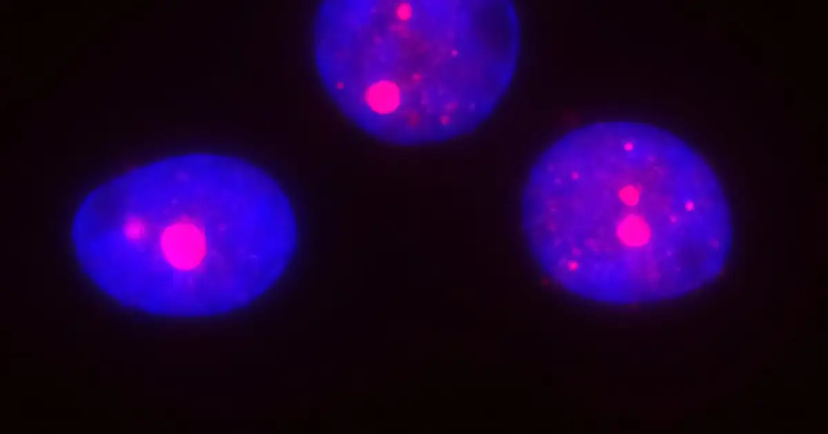 Biological mechanism underlying Huntington's disease may be more widespread in the brain than previously thought