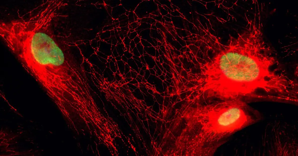 Blocking a mitochondrial transporter may curb inflammation from 'zombie' cells without killing them