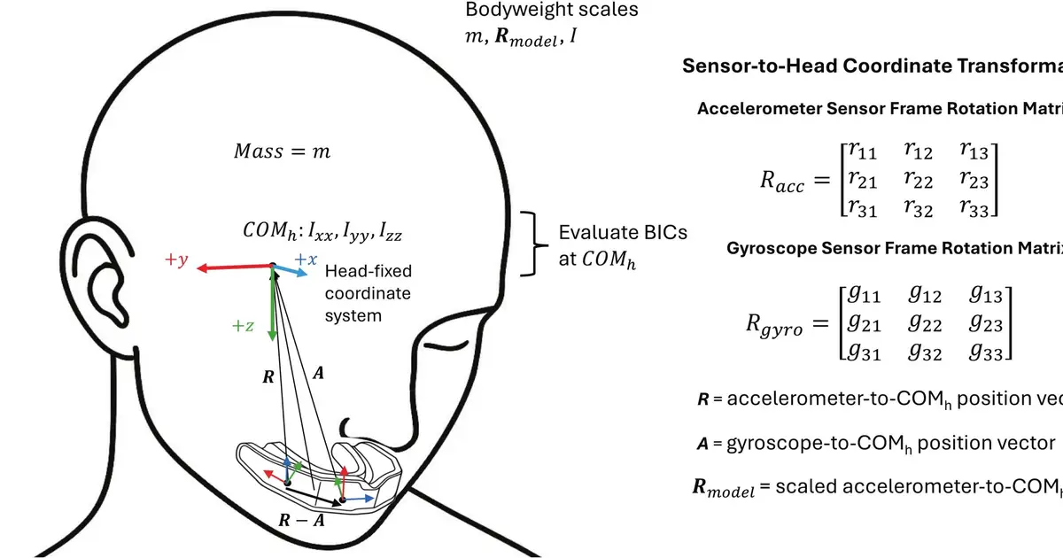 One-size-fits-all smart mouthguard data may overlook serious rugby head injuries