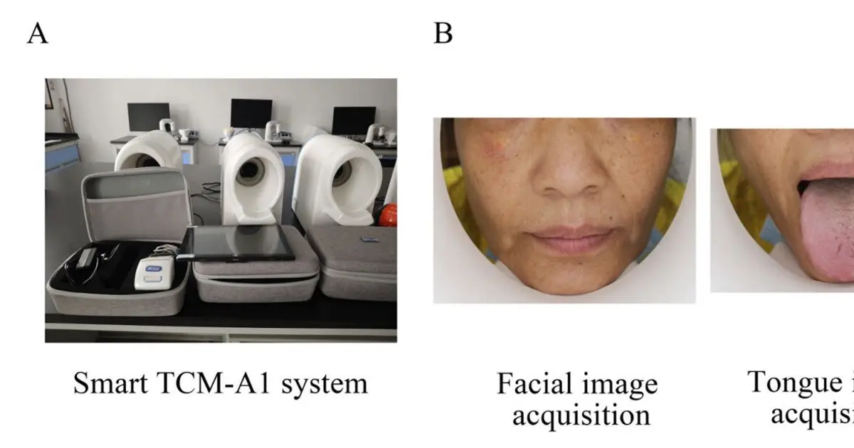 AI detects coronary heart disease from face and tongue photos in small test