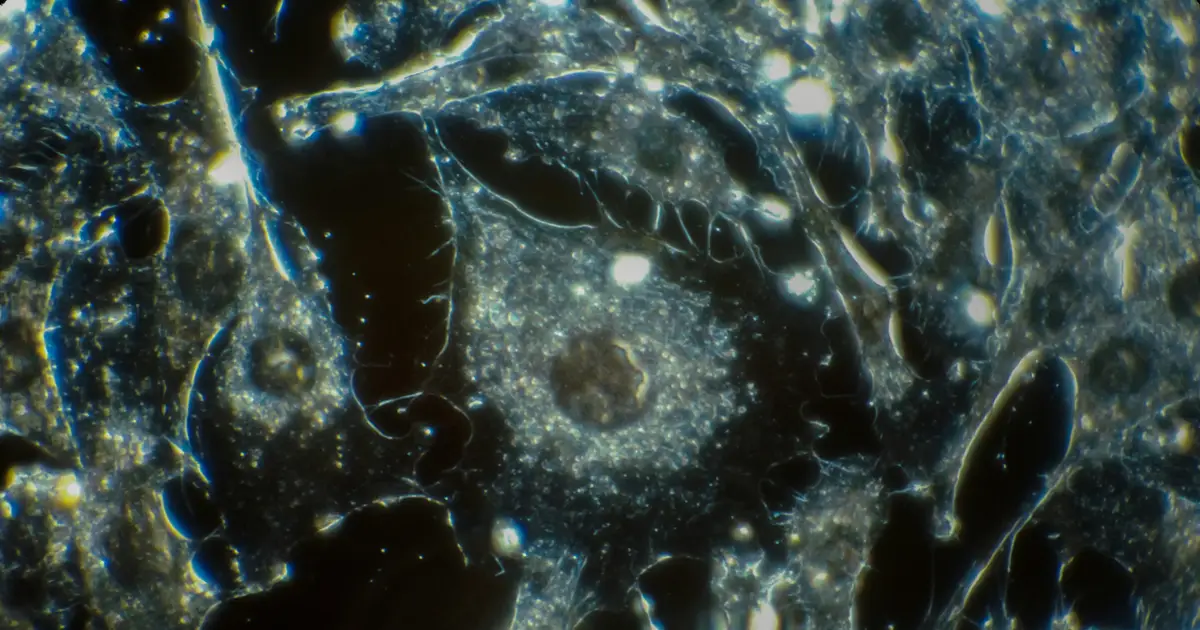 How does the cancer drug Keytruda work? And how is it different from chemo?
