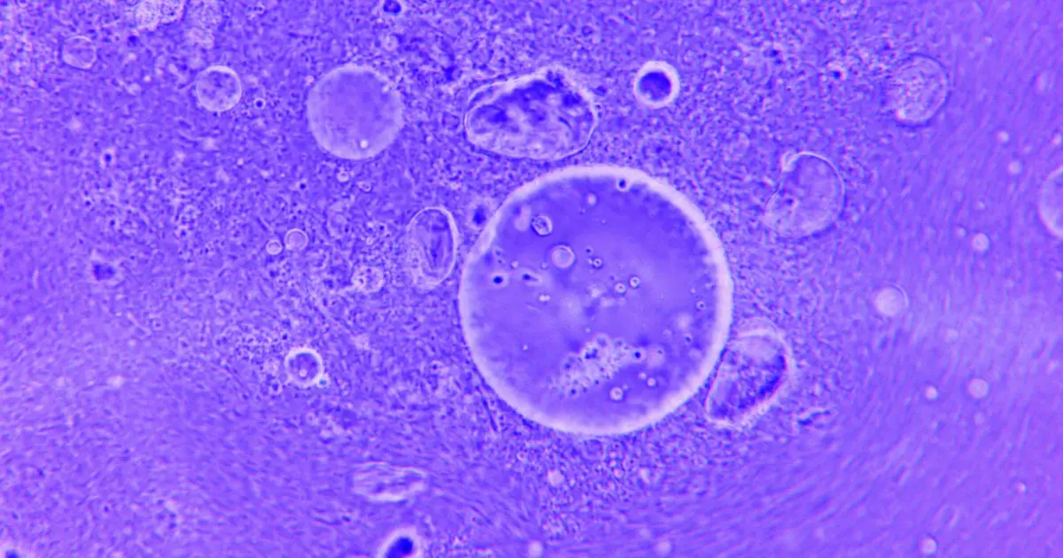 Creating synthetic life in a lab? SpudCell falls short of the goal, but raises even more useful questions