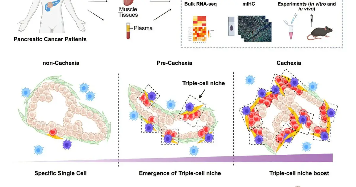 Cell network reveals how pancreatic cancer drives muscle and fat loss