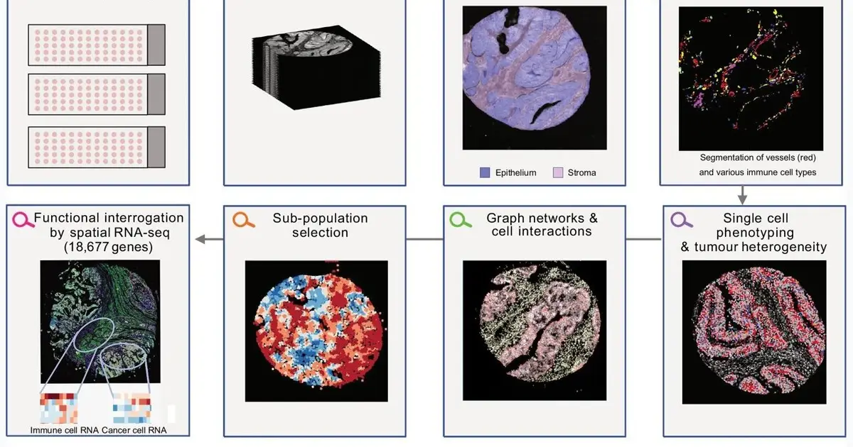 How cell type influences the impact of cancer-related protein activity in colorectal cancer