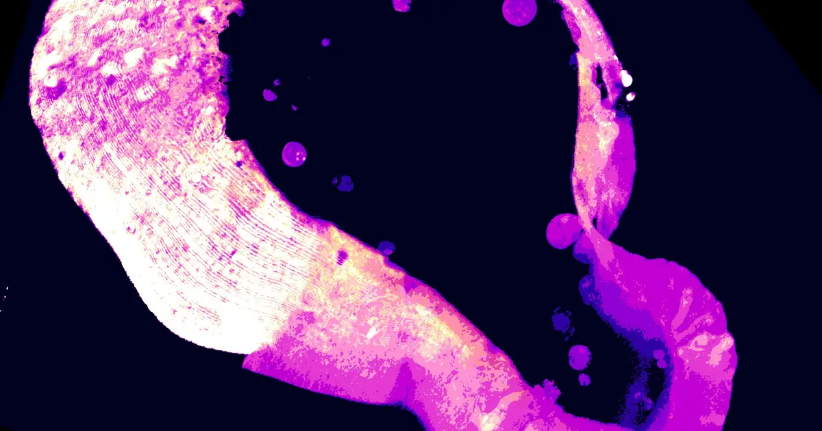 Cells use a little-known molecule to protect themselves from iron overload