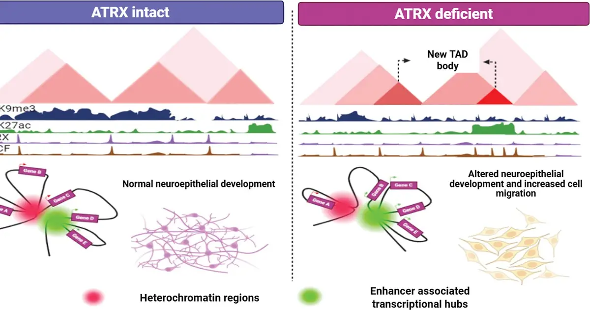 Common brain cancer mutation changes DNA shape to drive progression, exposing therapeutic target
