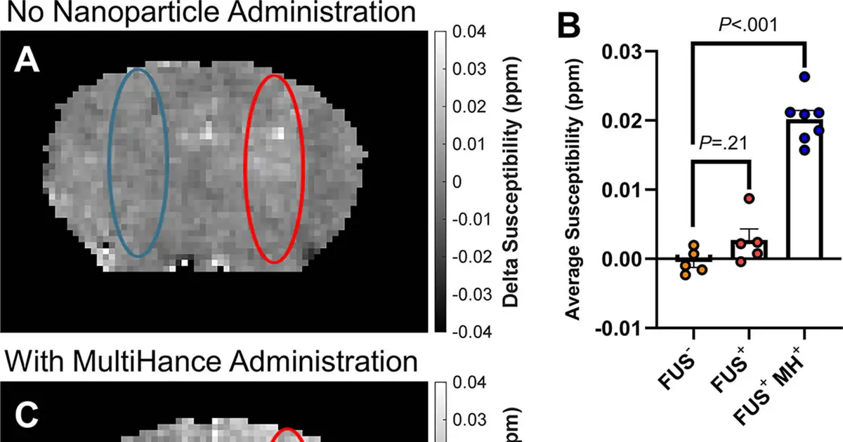 Deadly brain tumors show vulnerability to new sound wave approach