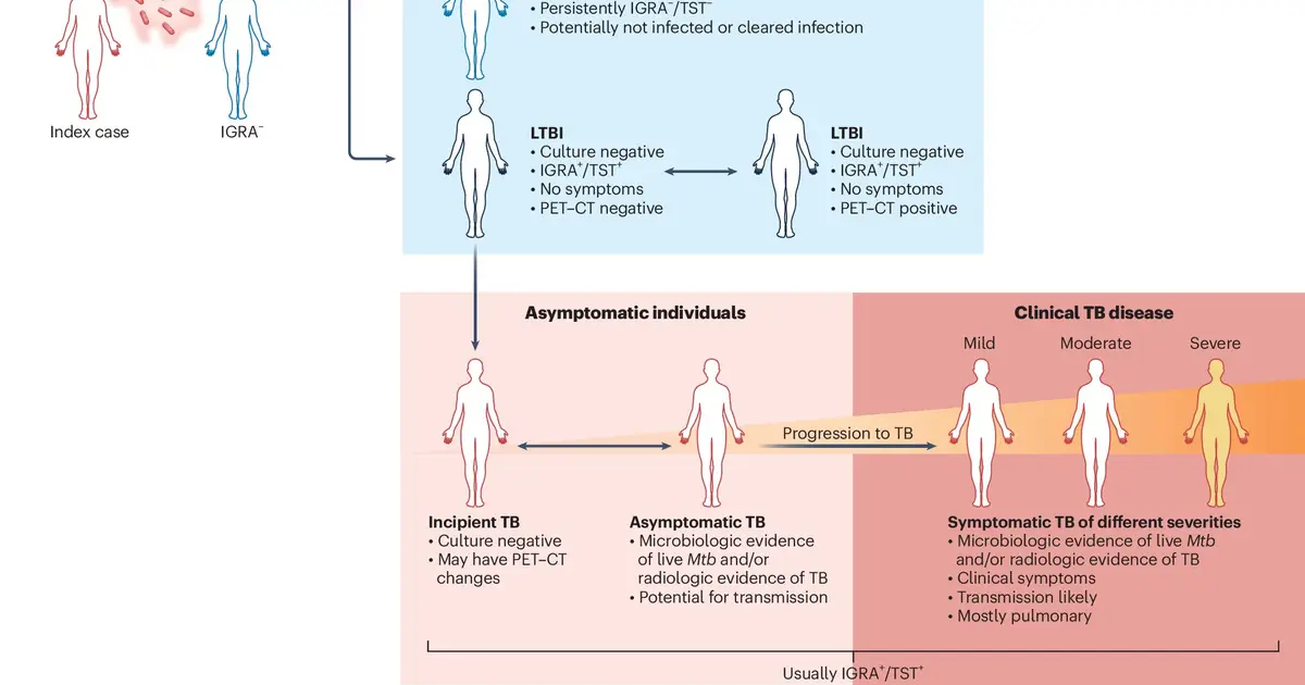 Early immune clues that determine who develops TB may lead to new ways to intervene earlier and stop the disease