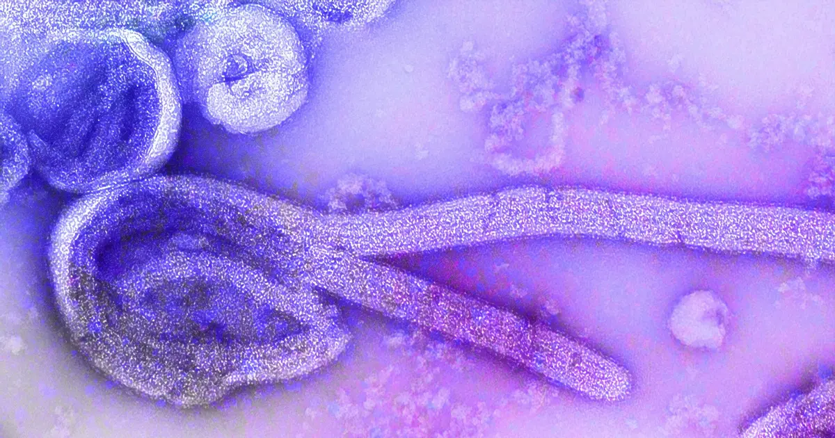 Egyptian group developing Ebola vaccine
