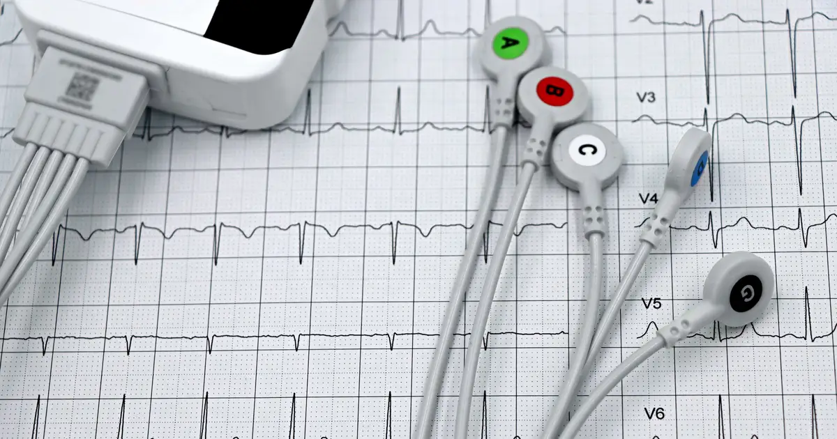 High-performance AI expands electrocardiogram analysis across medical tasks