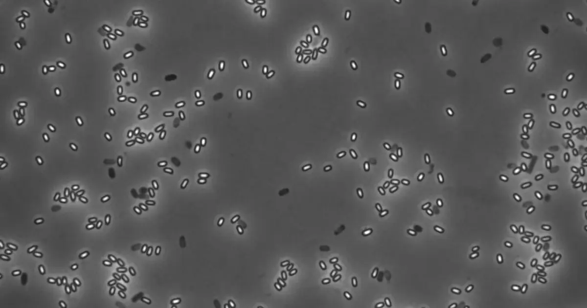 Engineered bacterial spores reveal new protein targets for enzymes and vaccines