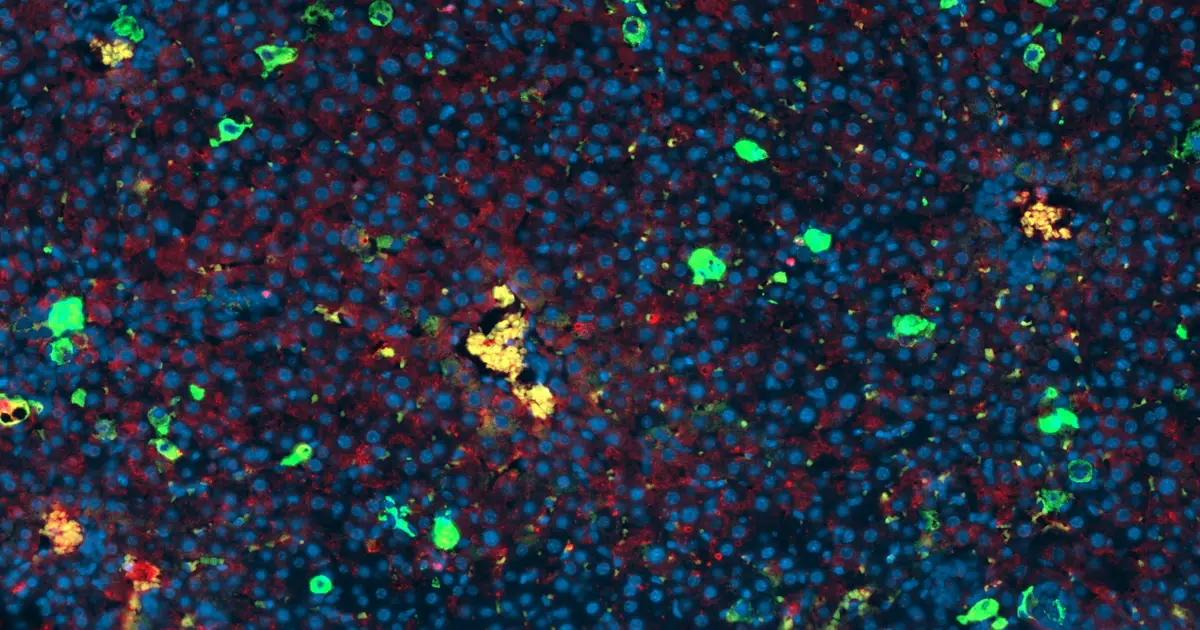 Exploiting a new vulnerability that targets 'zombie' cells as an anticancer therapy