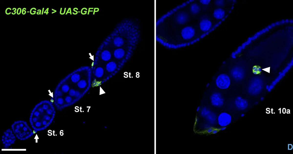 Extra sets of chromosomes may help aggressive tumor cells spread, study finds