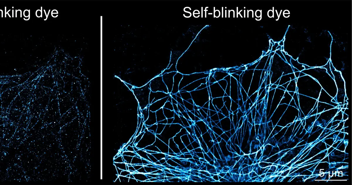 'Self-blinking dyes' simplify nanoscale imaging without sacrificing precision