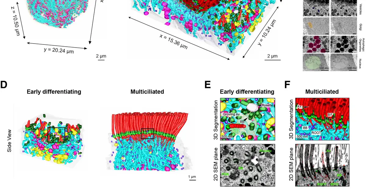First 3D nanoscale maps of human airway epithelium reveal hidden architecture of lung defense cells