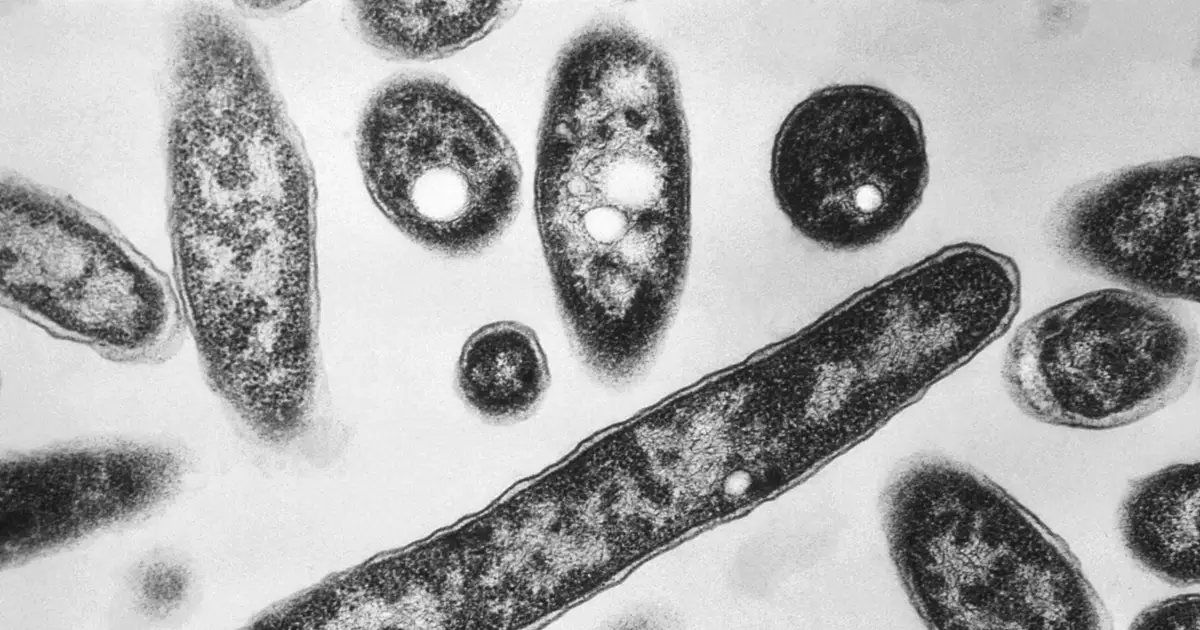 First death reported in Legionnaires' disease outbreak in New York City