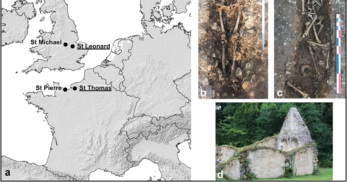 Medieval teeth open a new perspective on leprosy care and toxic medicine