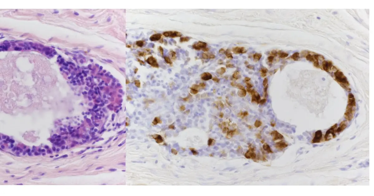 First successful primate transplant of human pituitary tissue boosts cortisol levels