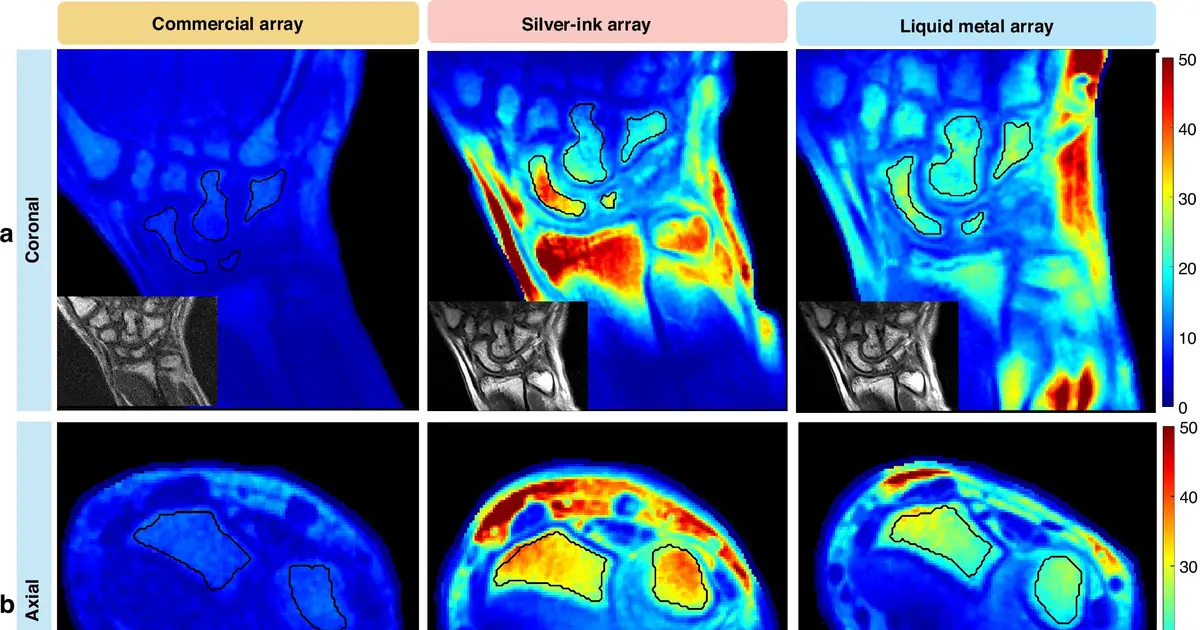 For the tiniest patients, new tech brings clearer MRI images