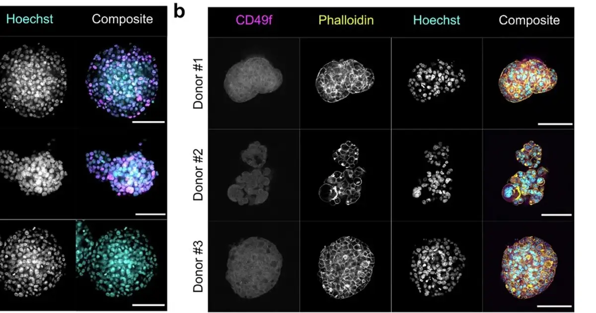 Forcing cancer cells to die can alert the immune system to enhance anti-tumor attack